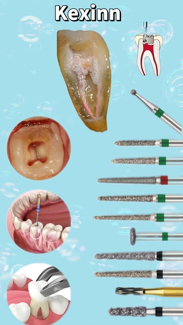 Kexinn Dental Polishing And Finishing Burs: Precision Tools For Optimal Dental Care