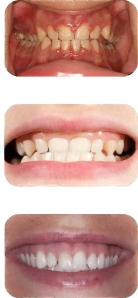 The Reasons Behind A Sweet Smile: Exploring Oral Cavity Health, Dental Tool Use, And Dental Restoration