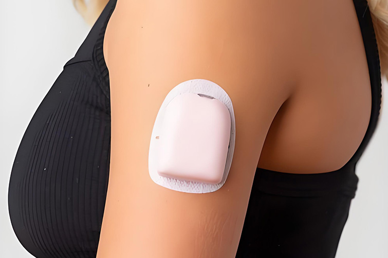 Can Continuous Glucose Monitor (CGM) Patches Cause Allergies? What You Need to Know