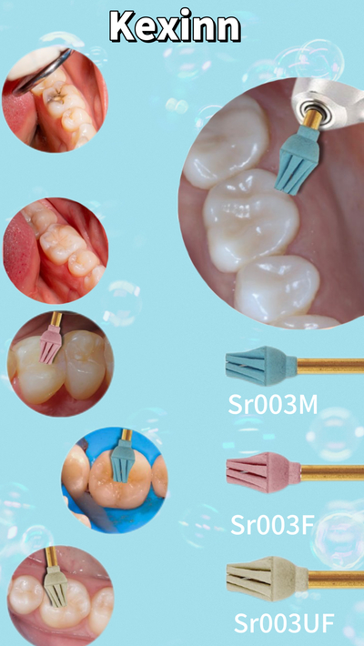 Kexin Sr003M Polisher: Redefining Posterior Restoration Polishing Standards and Demonstrating Professional Brand Strength